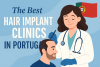 Melhores clínicas de implante capilar em Portugal bikrisohoj